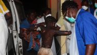 A badly burned child arrives at the Provincial Hospital in Tete on November 17, 2016, after a truck carrying petrol burst into flames. At least 43 people were killed and 110 others injured on November 17 when a truck carrying petrol blew up in western Moz