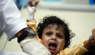 REPRESENTATIVE IMAGE: A Yemeni child suspected of being infected with cholera receives treatment in Sanaa on May 15, 2017. (AFP / Mohammed Huwais) 