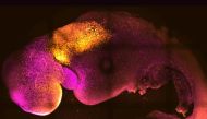 A microscope image provided by researchers Gianluca Amadei and Charlotte Handford in August 2022 shows a synthetic mouse embryo with colors added to show brain and heart formation. 