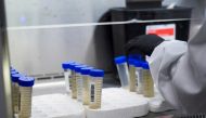 A lab technician tests wastewater samples from around the United States for the coronavirus disease (COVID-19) at the Biobot Analytics, in Cambridge, Massachusetts, US, on February 22, 2022. File Photo / Reuters
 
