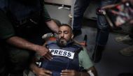 Photojournalist Sami Shahadeh arrives for treatment at the Al-Aqsa Martyrs Hospital in Deir el-Balah on April 12, 2024, after he was wounded by Israeli bombardment. (Photo by AFP)