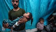 A man carries a girl injured in Israeli strikes on Bureij, at the Al-Aqsa Martyrs Hospital in Deir al-Balah in the central Gaza Strip on May 25, 2024. Photo by Bashar TALEB / AFP