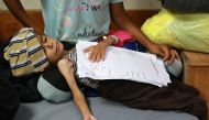 A malnourished Palestinian child lies at Al-Aqsa Martyrs Hospital in Deir al-Balah in the central Gaza Strip on May 30, 2024. Photo by Bashar TALEB / AFP