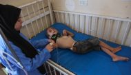 Palestinian boy Muhammad Shaaban suffering from malnutrition receives care at the Kamal Adwan hospital in Beit Lahia in the northern Gaza Strip on July 2, 2024. (Photo by Omar Al-Qattaa / AFP)
