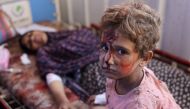 An injured child sits next to a woman at Al-Ahli Arab hospital, also known as the Baptist hospital in Gaza City following Israeli bombardment on the Hassan Salameh and Al-Nassr schools housing displaced Palestinians on August 4, 2024. Photo by Omar AL-QATTAA / AFP.