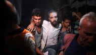 Palestinians help a man injured in an Israeli strike that targeted a mosque-turned-shelter in Deir al-Balah in the central Gaza Strip. (Photo by Bashar Taleb / AFP)