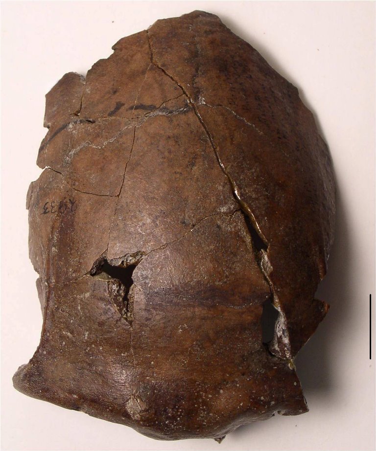 The cranium of a person who lived in what's now Papua New Guinea, 6,000 years ago is pictured in this undated handout photo obtained by Reuters October 25, 2017. Arthur Durband/The Field Museum/Handout via REUTERS