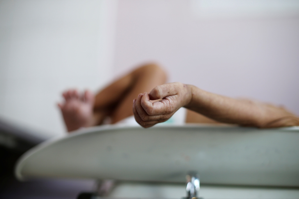 A malnourished boy lies on a weighing scale at the malnutrition ward of al-Sabeen hospital in Sanaa, Yemen September 11, 2018. Picture taken September 11, 2018. Reuters/Khaled Abdullah 