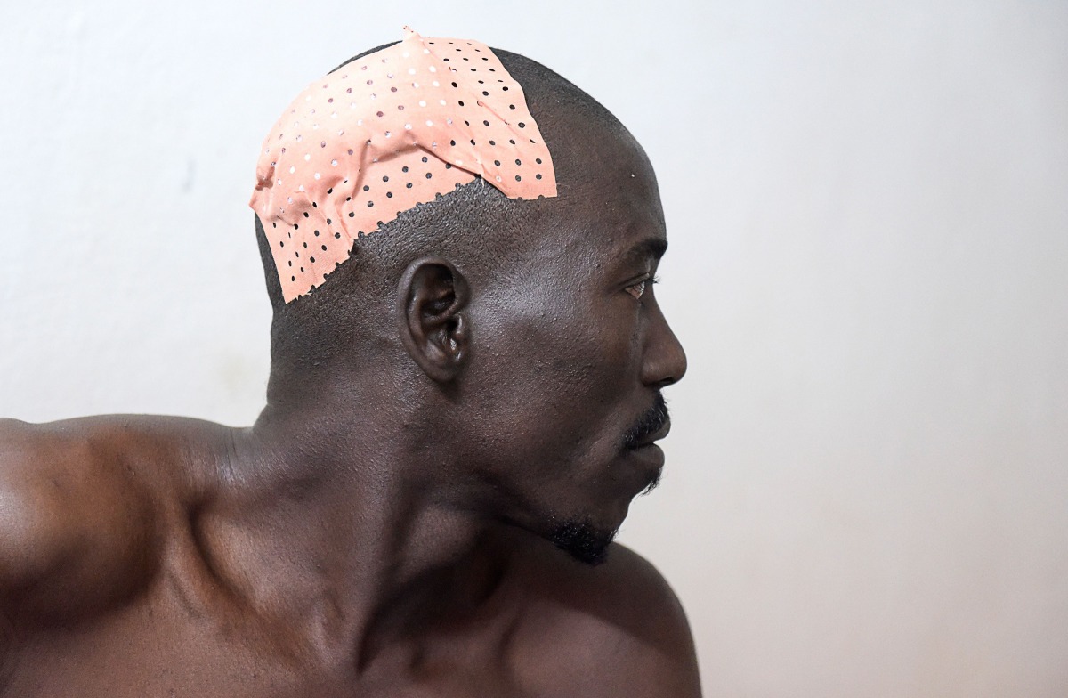 A victim of an attack by armed men in the Bayotte forest waits after being treated in the regional capital Ziguinchor, southern Senegal on January 7, 2018. AFP/Seyllou