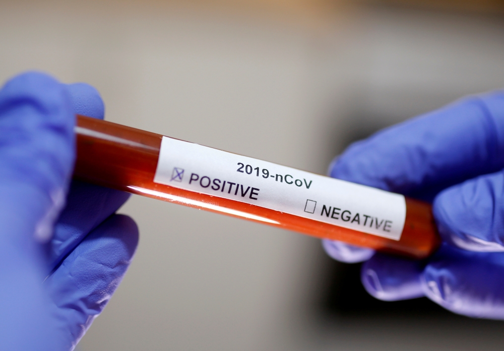 FILE PHOTO: Test tube with corona virus name label is seen in this illustration taken on January 29, 2020. REUTERS/Dado Ruvic/File Photo