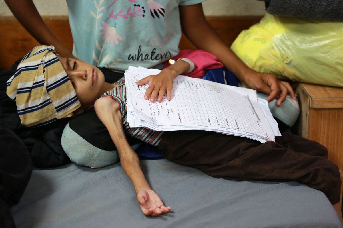 A malnourished Palestinian child lies at Al-Aqsa Martyrs Hospital in Deir al-Balah in the central Gaza Strip on May 30, 2024. Photo by Bashar TALEB / AFP