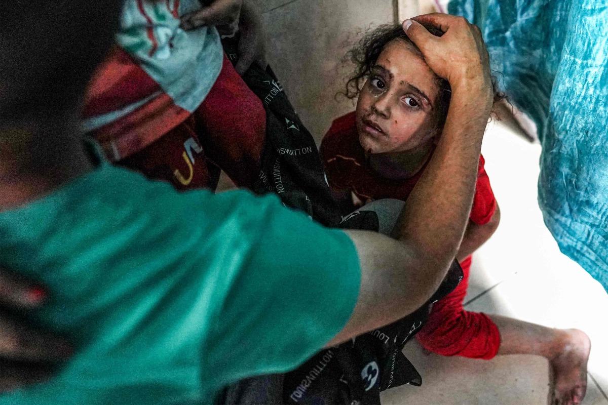 An injured child reacts following Israeli bombardment on al-Bureij, as she sits on the floor at a ward at the Aqsa Martyrs hospital in Deir el-Balah in the central gaza Strip on June 4, 2024. (Photo by Bashar TALEB / AFP)
