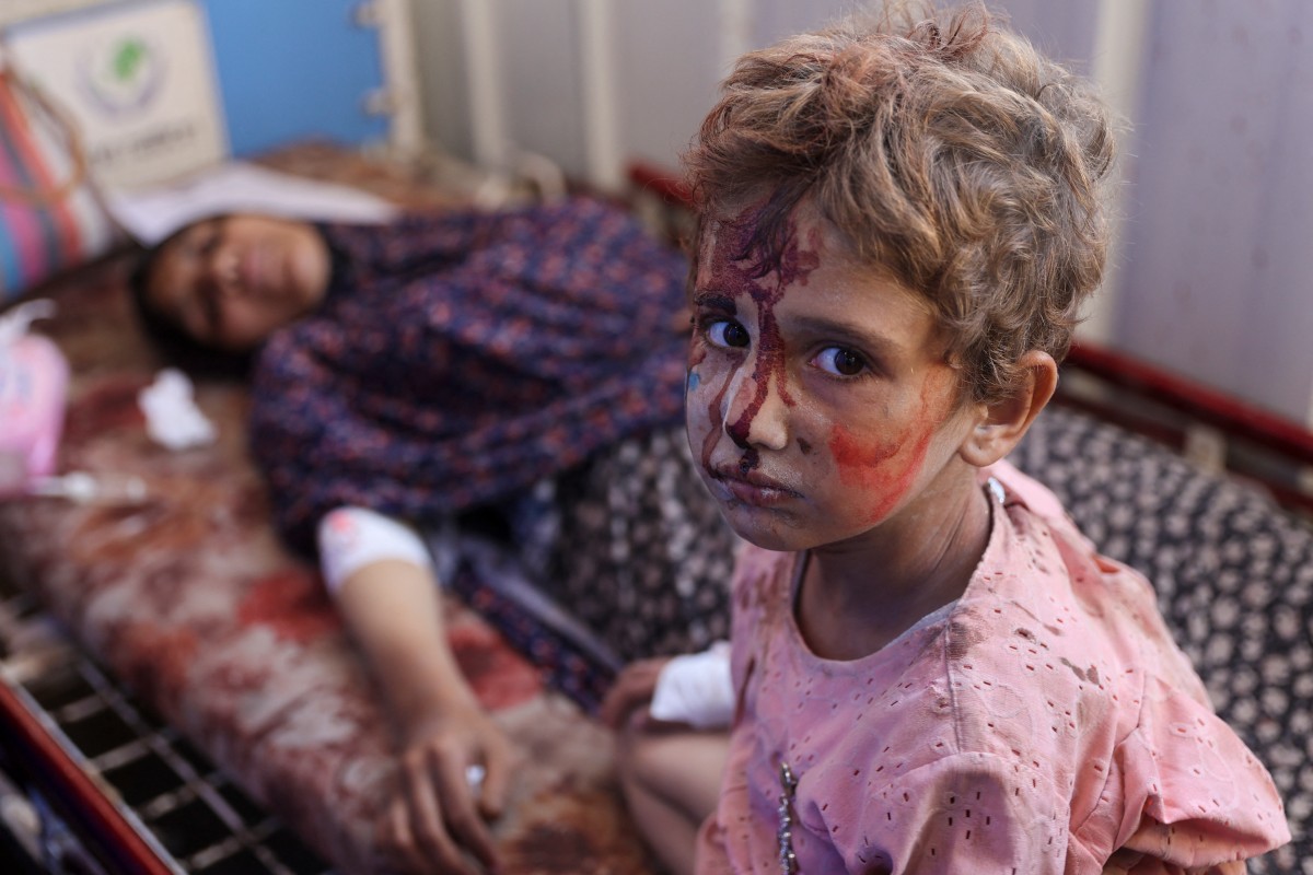 An injured child sits next to a woman at Al-Ahli Arab hospital, also known as the Baptist hospital in Gaza City following Israeli bombardment on the Hassan Salameh and Al-Nassr schools housing displaced Palestinians on August 4, 2024. Photo by Omar AL-QATTAA / AFP.