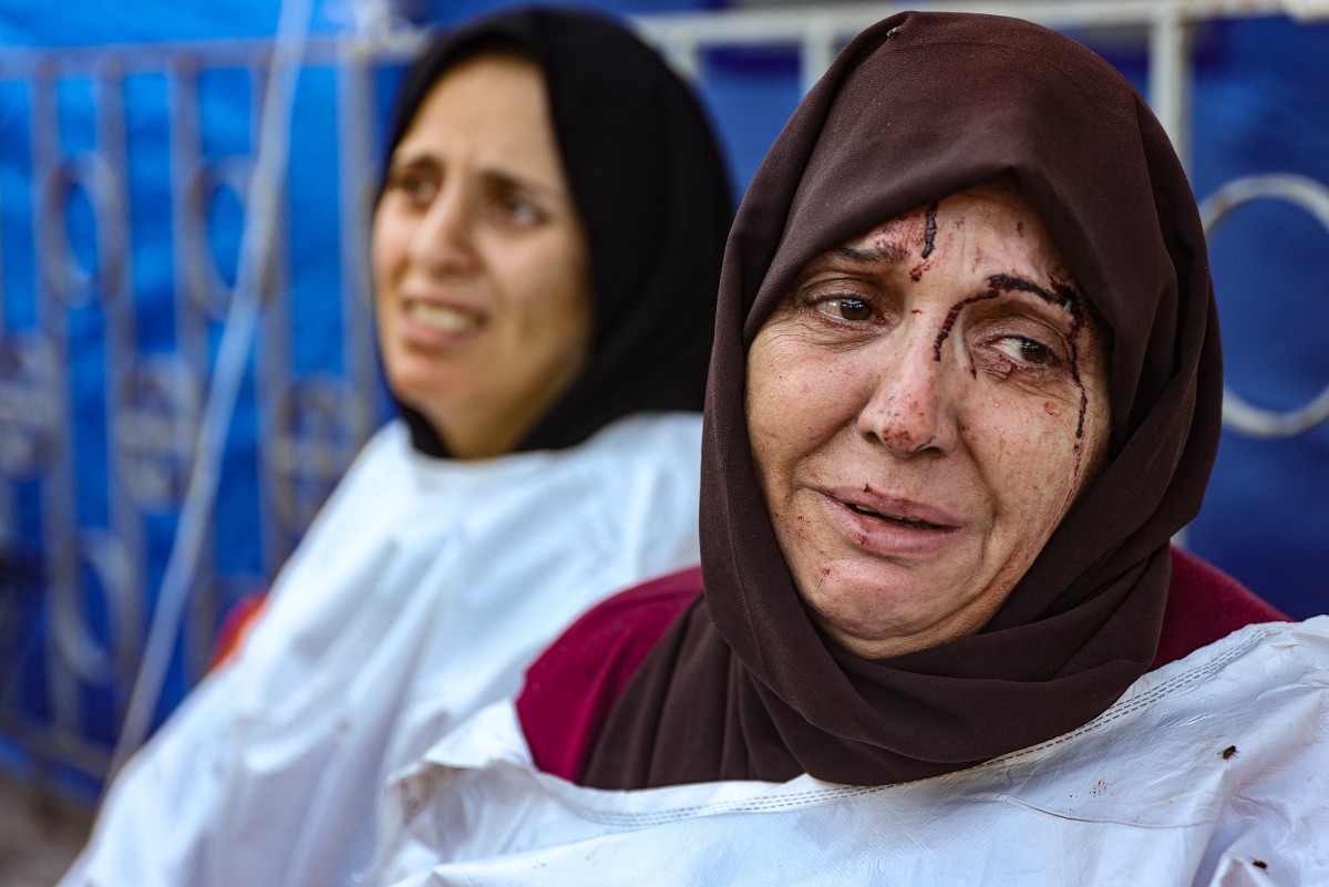 An injured woman reacts after identifying a member of her family among the dead at the al-Maamadani hospital, following an Israeli strike that killed more than 90 people on a school sheltering displaced Palestinians in Gaza City on August 10, 2024. Photo by Omar AL-QATTAA / AFP.