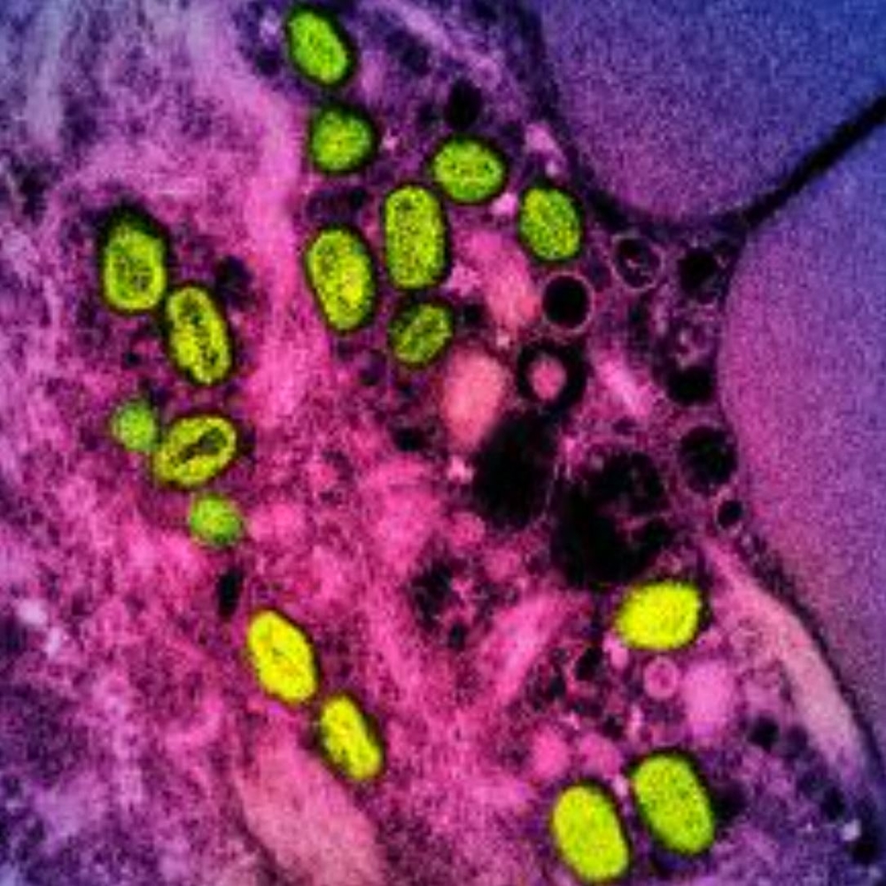 (FILES) This undated file image obtained from the National Institute of Allergy and Infectious Diseases (NIAID) in Bethesda, Maryland, shows a colorized transmission electron micrograph of monkeypox particles (green) found within an infected cell (pink and purple), cultured in the laboratory. (Photo by Handout / National Institute of Allergy and Infectious Diseases / AFP) 
