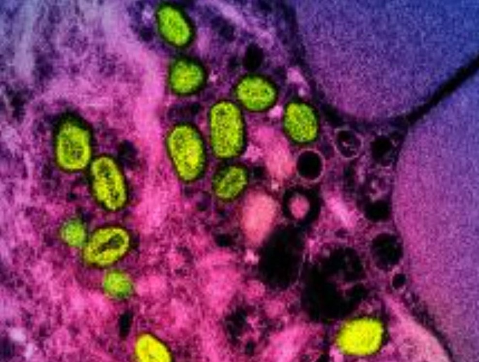 File: This undated file image obtained from the National Institute of Allergy and Infectious Diseases (NIAID) in Bethesda, Maryland, shows a colorised transmission electron micrograph of monkeypox particles (green) found within an infected cell (pink and purple), cultured in the laboratory. (Photo by Handout / National Institute of Allergy and Infectious Diseases / AFP)