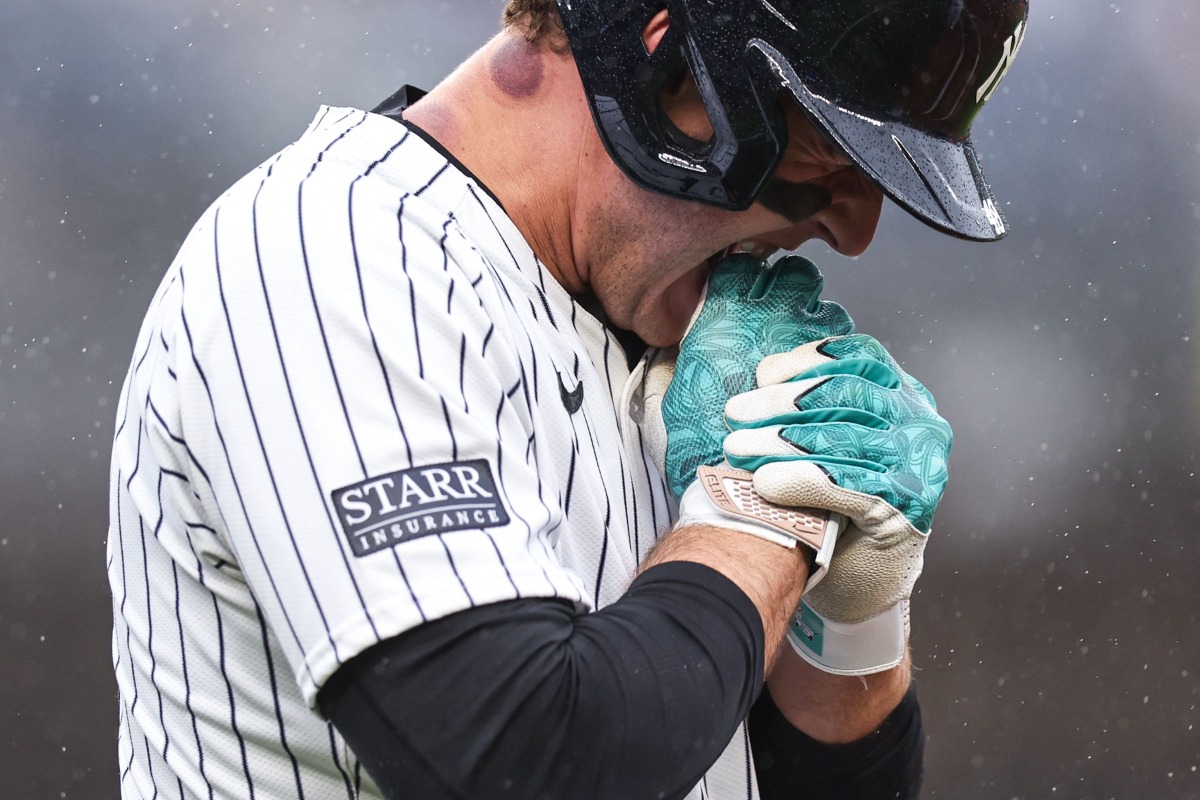 Anthony Rizzo #48 of the New York Yankees bites his hand after being hit by a pitch during the seventh inning of the game against the Pittsburgh Pirates at Yankee Stadium on September 28, 2024 in New York City. (Photo by Dustin Satloff / GETTY IMAGES NORTH AMERICA / Getty Images via AFP)
