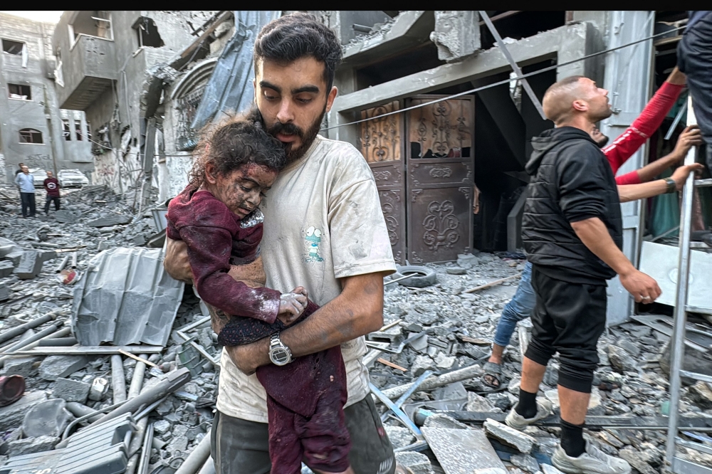 A Palestinian man carries away an injured child from a home that was hit in an Israeli strike on the Jabalia refugee camp on November 7, 2024. (Photo by AFP)